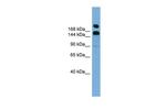 UGGT1 Antibody in Western Blot (WB)