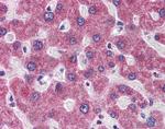 RHBG Antibody in Immunohistochemistry (IHC)