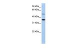 RHBG Antibody in Western Blot (WB)