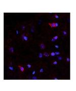 NTN4 Antibody in Immunohistochemistry (IHC)