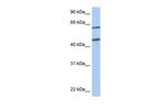 NTN4 Antibody in Western Blot (WB)