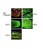 PORCN Antibody in Immunohistochemistry (IHC)