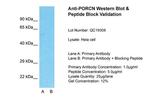 PORCN Antibody in Western Blot (WB)