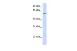 PORCN Antibody in Western Blot (WB)