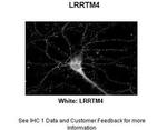 LRRTM4 Antibody in Immunohistochemistry (IHC)