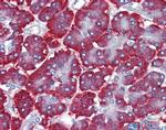 FEZF1 Antibody in Immunohistochemistry (IHC)