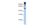 FEZF1 Antibody in Western Blot (WB)