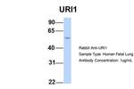 RMP Antibody in Western Blot (WB)