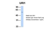 RMP Antibody in Western Blot (WB)