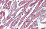 MAS1 Antibody in Immunohistochemistry (IHC)