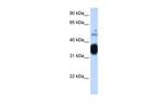 TNNT3 Antibody in Western Blot (WB)