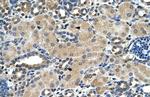 ASPH Antibody in Immunohistochemistry (IHC)