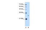 ASPH Antibody in Western Blot (WB)