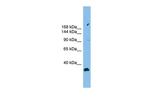 PACS2 Antibody in Western Blot (WB)