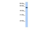 CYP11A1 Antibody in Western Blot (WB)