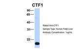 Cardiotrophin 1 Antibody in Western Blot (WB)