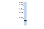 Cardiotrophin 1 Antibody in Western Blot (WB)