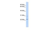 LYPLA1 Antibody in Western Blot (WB)