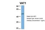 VAT1 Antibody in Western Blot (WB)