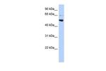 AP3M2 Antibody in Western Blot (WB)