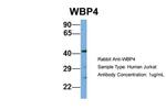 WBP4 Antibody in Western Blot (WB)