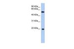 CRYGC Antibody in Western Blot (WB)