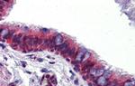 hCV-2 Antibody in Immunohistochemistry (IHC)