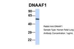 LRRC50 Antibody in Western Blot (WB)