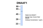 LRRC50 Antibody in Western Blot (WB)