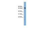 GCLC Antibody in Western Blot (WB)