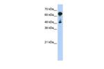 HSPA6 Antibody in Western Blot (WB)