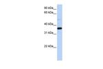 PTGR1 Antibody in Western Blot (WB)