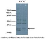 PYCR2 Antibody in Western Blot (WB)