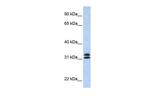 PYCR2 Antibody in Western Blot (WB)