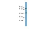 Glutaminase Antibody in Western Blot (WB)