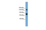 AGTPBP1 Antibody in Western Blot (WB)