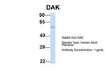 DAK Antibody in Western Blot (WB)