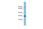 C1orf77 Antibody in Western Blot (WB)