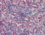 MKNK2 Antibody in Immunohistochemistry (IHC)