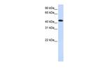 MKNK2 Antibody in Western Blot (WB)