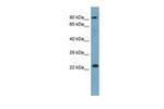 K-Ras Antibody in Western Blot (WB)