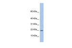 NDP Antibody in Western Blot (WB)