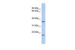 MTHFD2L Antibody in Western Blot (WB)