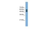 PGM1 Antibody in Western Blot (WB)