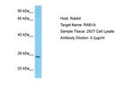 RAB1A Antibody in Western Blot (WB)