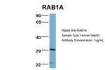 RAB1A Antibody in Western Blot (WB)