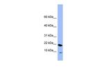 PIN4 Antibody in Western Blot (WB)