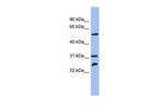 PSMC4 Antibody in Western Blot (WB)