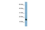 MED31 Antibody in Western Blot (WB)