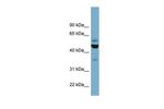 TUBE1 Antibody in Western Blot (WB)